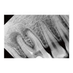 Sensor radiologia digital SIGER - Image 6